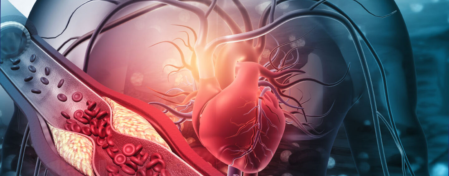 Mental Illness Linked to Higher Heart Disease Risk and Shorter Lives