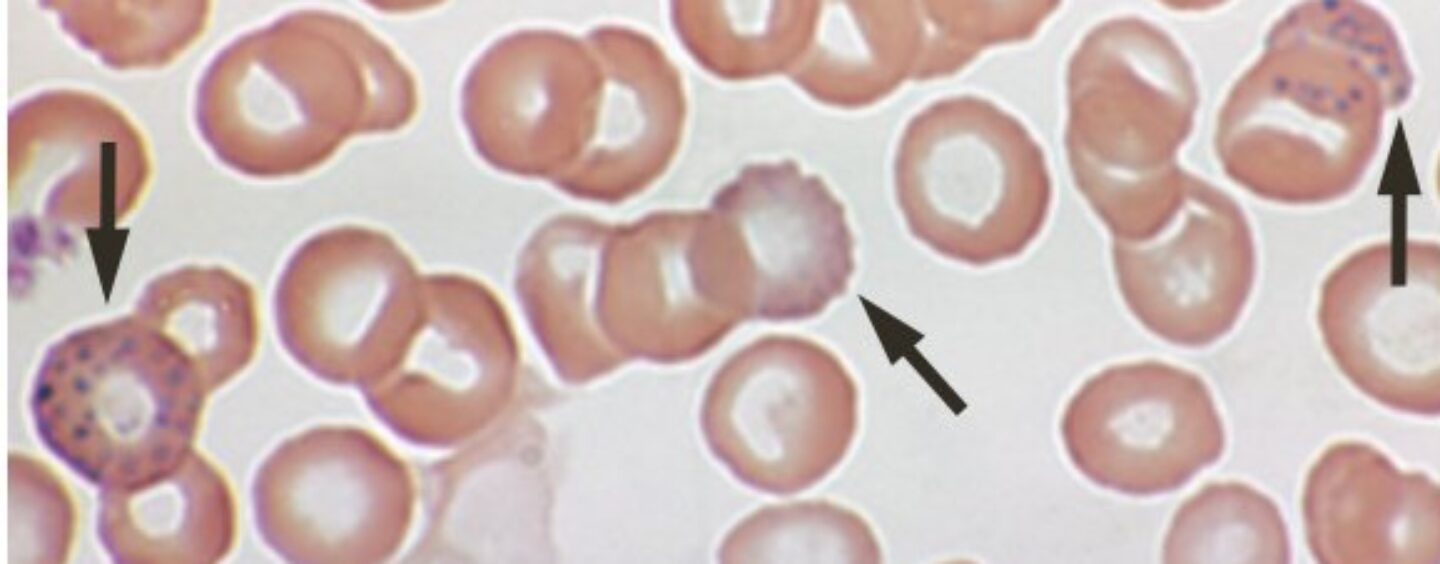 Biden-Harris Administration Advances Ambitious Plan to Eliminate Lead Exposure