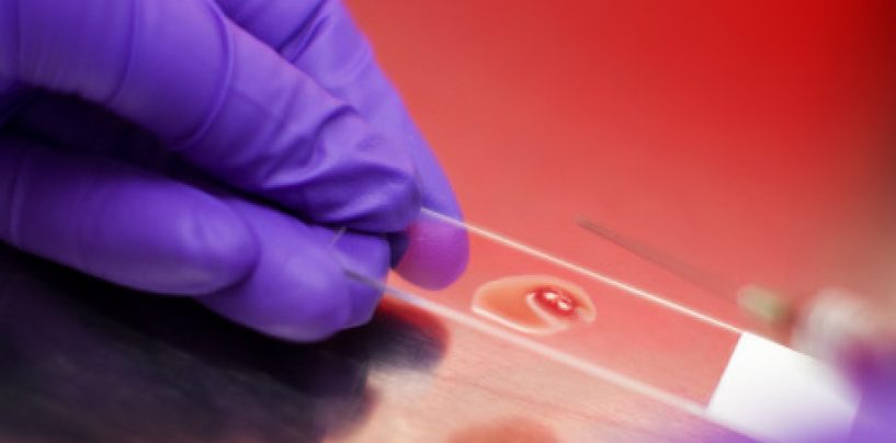 Ask Dr. Kevin: Out with the Old, In with a New Understanding to Improve SCD Care