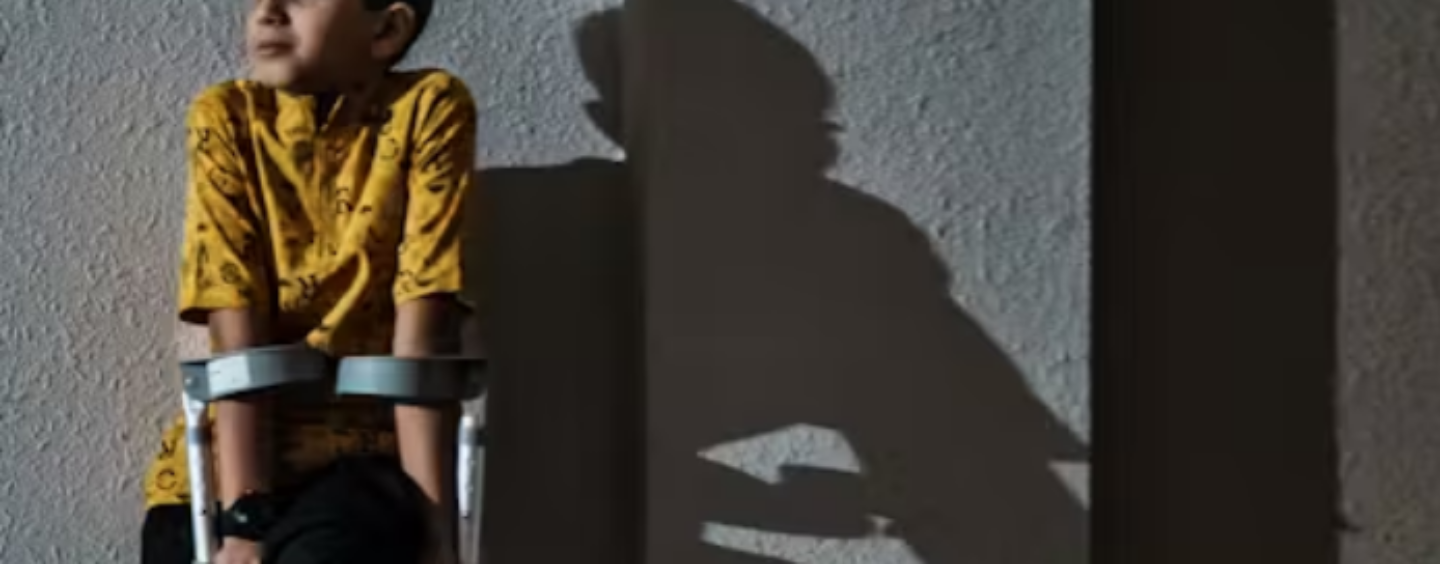 Palestinian Writers Have Long Explored the Horrors of Amputation