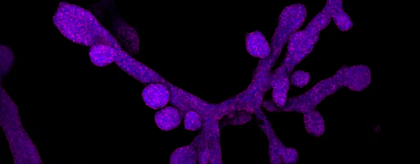 Mammary Glands in a Dish − What Miniature Organs Reveal About Evolution, Lactation, Regeneration and Breast Cancer
