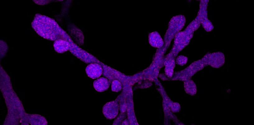 Mammary Glands in a Dish − What Miniature Organs Reveal About Evolution, Lactation, Regeneration and Breast Cancer