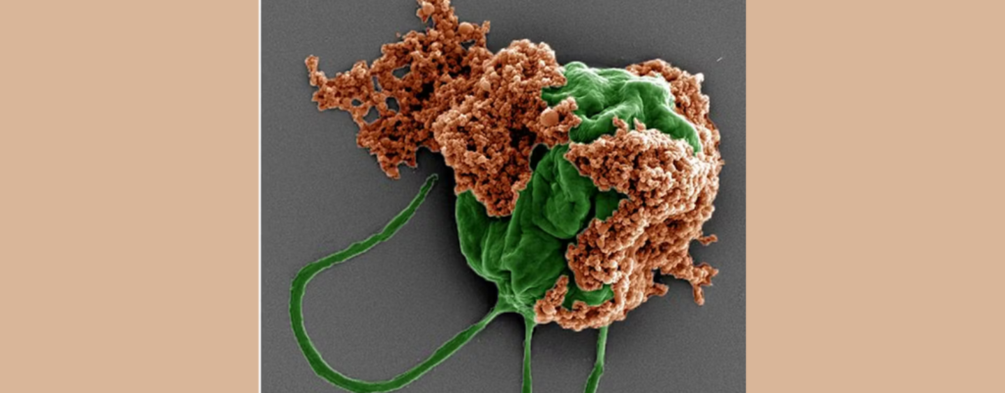 Microrobots Made of Algae Carry Chemo Directly to Lung Tumors, Improving Cancer Treatment