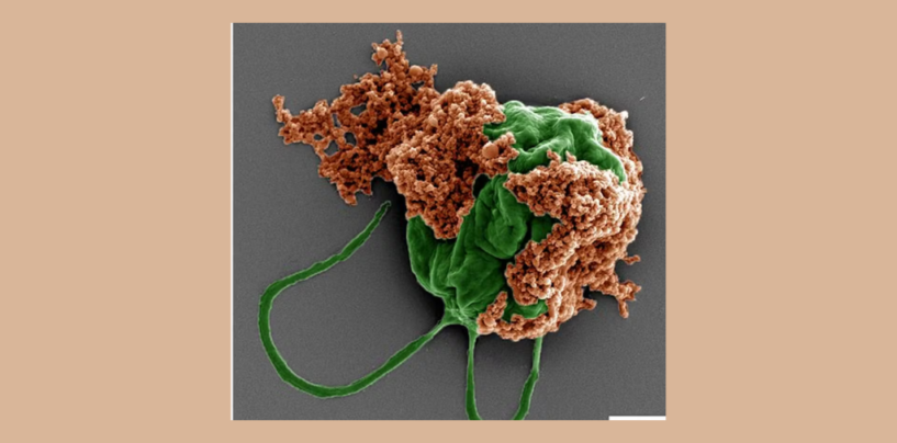 Microrobots Made of Algae Carry Chemo Directly to Lung Tumors, Improving Cancer Treatment