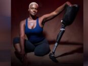 Empowering People With Disabilities – Black Athlete, Whose Leg Was Amputated After a Cancer Diagnosis